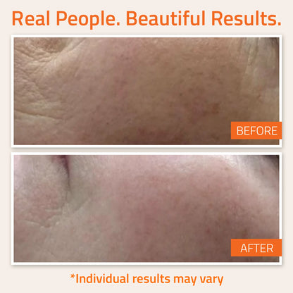 Vitamin C &amp; E Serum Vitamin C &amp; E Serum