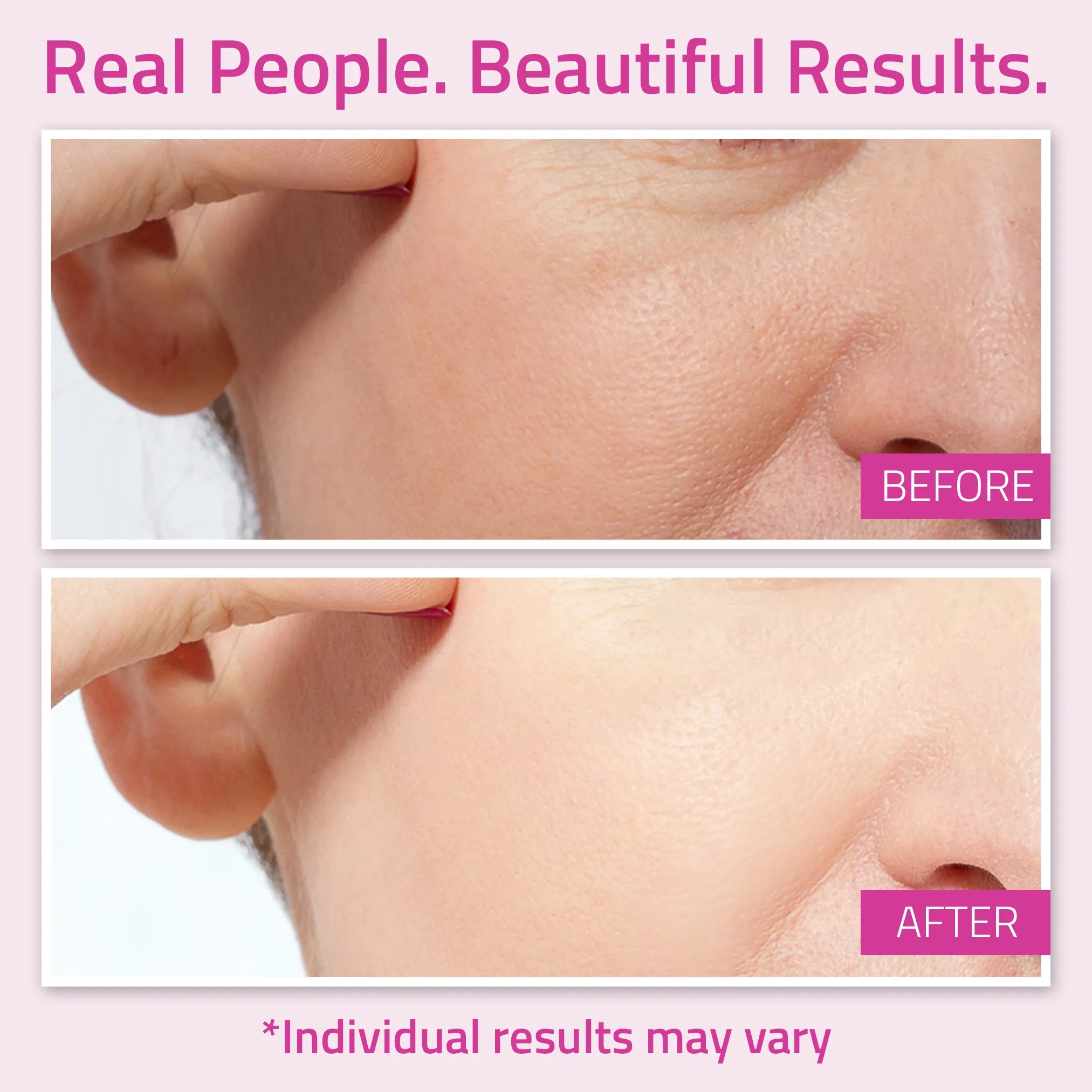 Before-and-after close-up showing smoother-looking skin texture after using YEOUTH Anti-Aging Moisturizer L22.