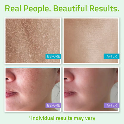 Before and after close-up comparisons showing smoother and clearer skin from using skin care products for men