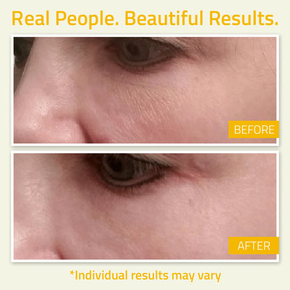 Niacinamide Serum Close-up before and after images showing visible skin improvement after using YEOUTH glow serum.