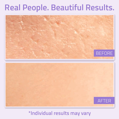 Before-and-after skin comparison showing smoother texture after using YEOUTH best night cream. Results may vary.
