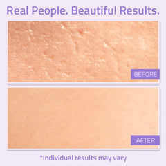 Before-and-after skin comparison showing smoother texture after using YEOUTH best night cream. Results may vary.