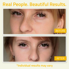 Before and after eye area results showing reduced visible puffiness and smoother look from YEOUTH Radiance Eye Gel.